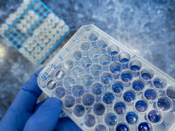 lab-back-and-woman-for-science-research-bio-technology-and-gene-mutation-with-laptop-for-data-analysis-bioinformatics-innovation-study-and-beaker-with-chemical-life-expansion-and-development