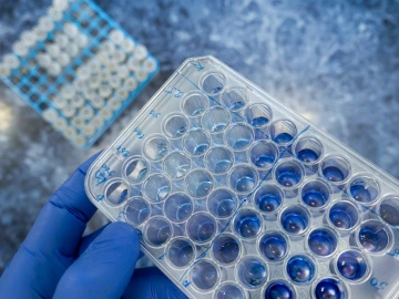 lab-back-and-woman-for-science-research-bio-technology-and-gene-mutation-with-laptop-for-data-analysis-bioinformatics-innovation-study-and-beaker-with-chemical-life-expansion-and-development